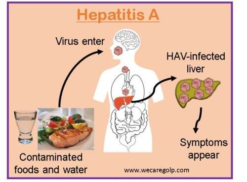 Cara penularan Hepatitis A 